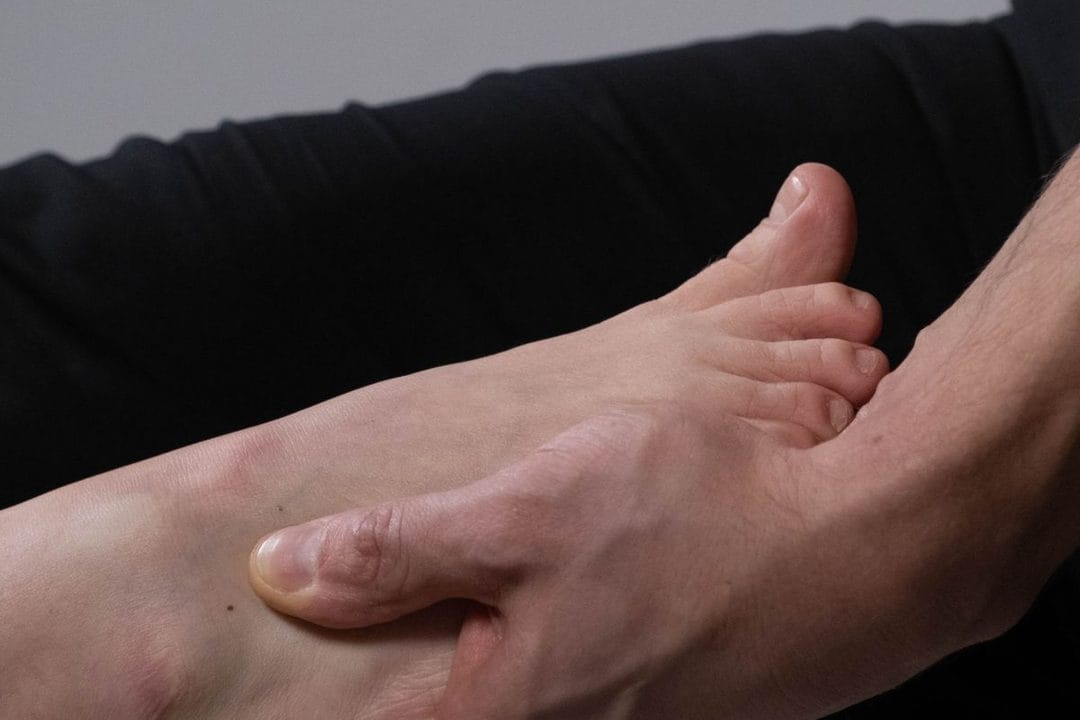 Gout After 40: The Metabolic Warning Behind the Big Toe Attack